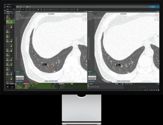 FDA 승인 'AI 영상' 기업 코어라인소프트, 신한제7호스팩 통해 코스닥 상장 추진