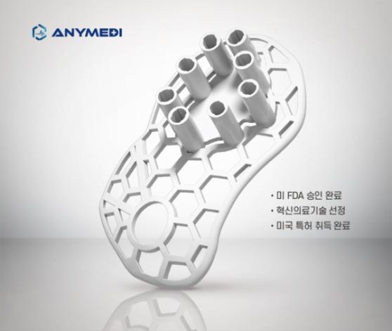 애니메디솔루션, 3D 프린팅 기반 ‘유방보존술 가이드’ 美특허